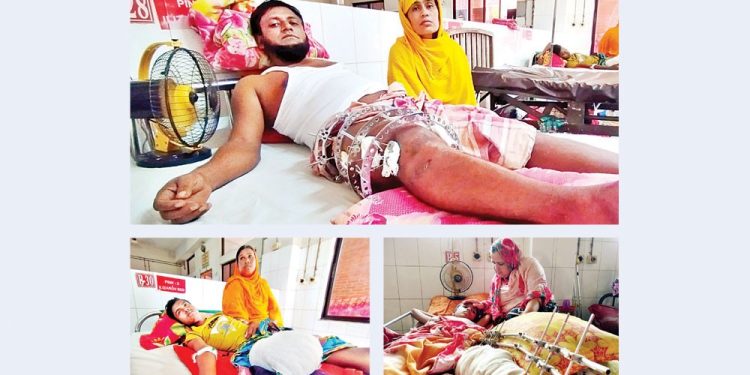 ভবিষ্যৎ নিয়ে দুশ্চিন্তায় আন্দোলনে অঙ্গহারা মানুষ