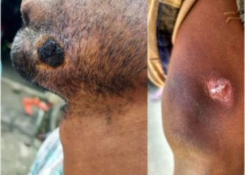 নাটোরে গবাদি পশু থেকে মানবদেহে ছড়িয়ে পড়ছে ‘অ্যানথ্রাক্স’